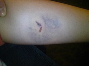 На рівненських студентів нападають безпритульні пси