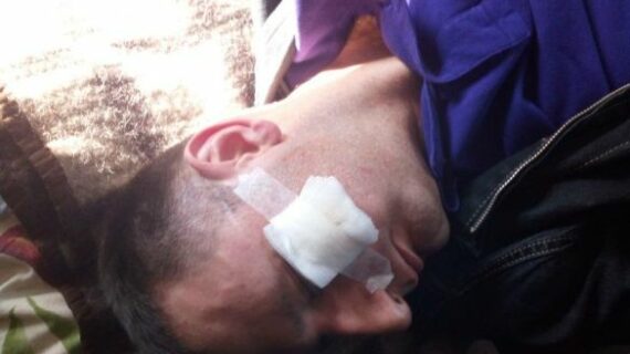 Через побиття волинських журналістів поліція відкрила кримінальну справу