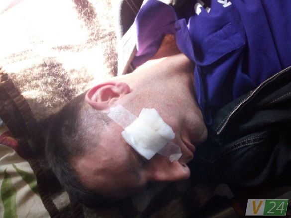 Через побиття волинських журналістів поліція відкрила кримінальну справу